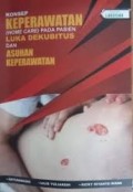 Konsep Keperawatan (Home Care) Pada Pasien Luka Dekubitus Dan Asuhan Keperawatan